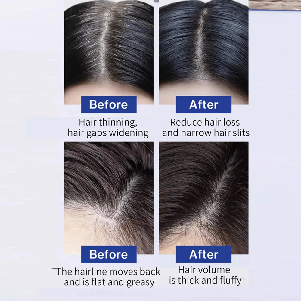 FEG Plus - Minoxidil Hair Growth Spray